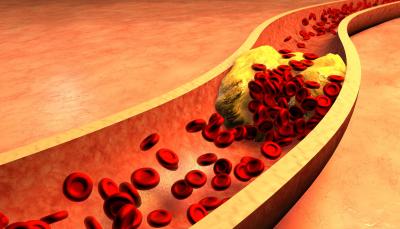 Lester’s Oil Human Study Results – HDL cholesterol